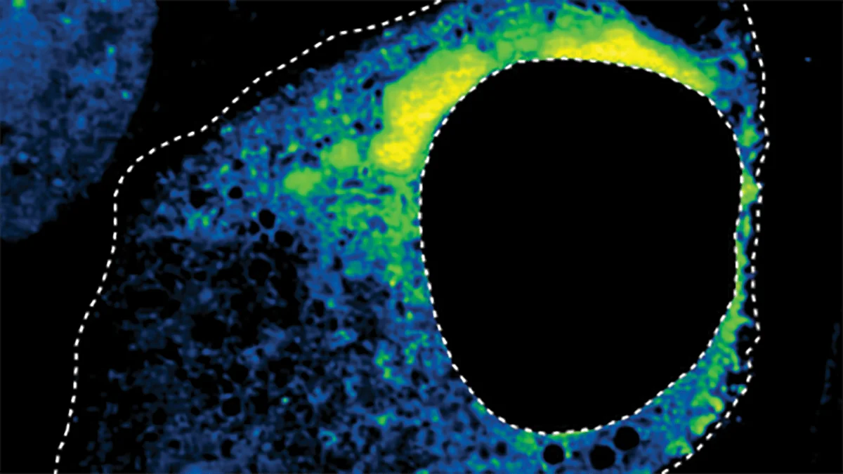 AI Predicts Gene Regulation for Drug Discovery Using Condensate Morphology
