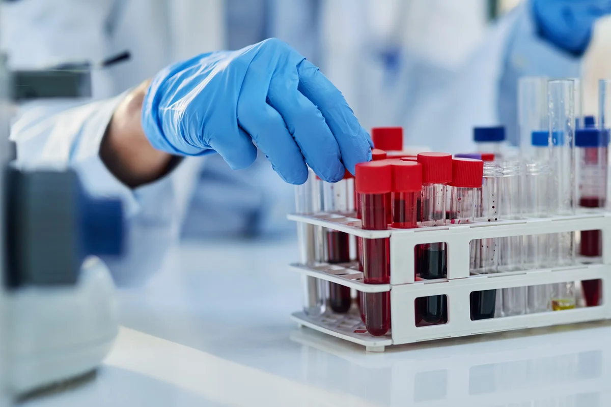 New Blood Test for Early Alzheimer’s Detection with FNIH’s Dr. Alessio Travaglia — Episode 255