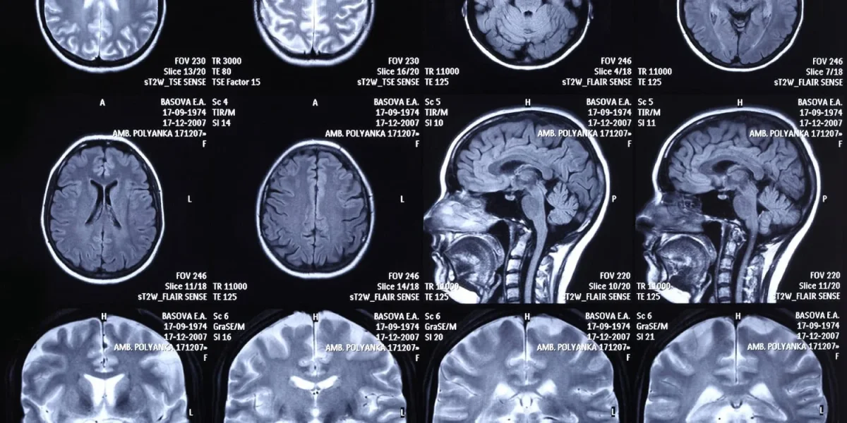 Brain Scans Reveal Democrats and Republicans Use Different Neural Pathways to Buy Groceries
