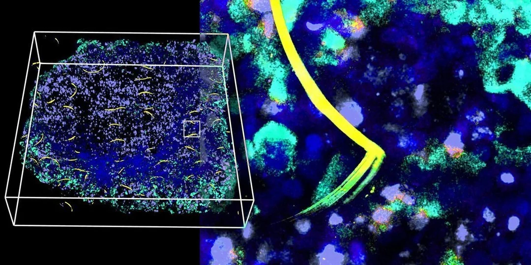 Cyborg Organoids Sense Glucose, Release Hormones for Diabetes