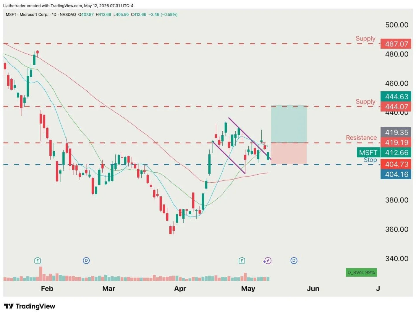 Microsoft Poised for Breakout if It Holds $404