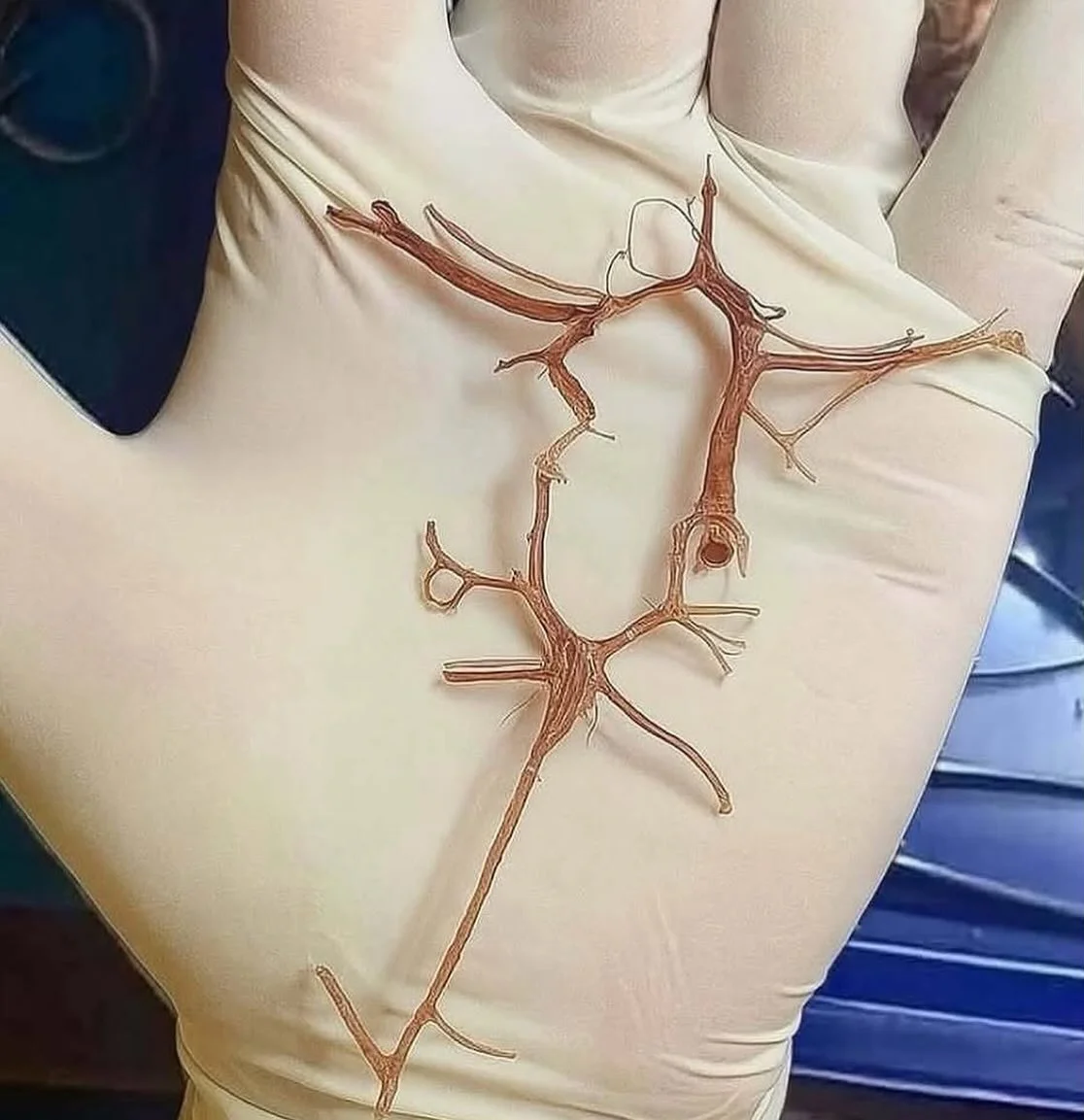 Circle of Willis: Brain’s Natural Blood Flow Backup