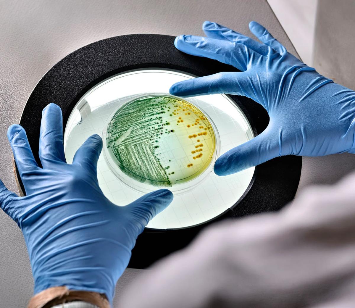 Genomic Mapping of E. Coli Capsules Identifies High-Risk Types for Vaccines