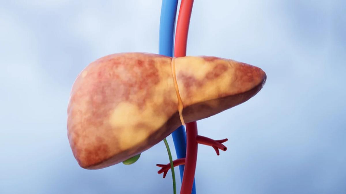 All Eyes on Vertex’s Kidney Franchise, as Painkiller Journavx Tops Half a Million Scripts