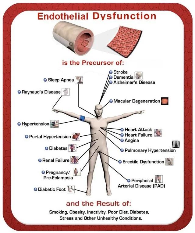 Introducing a Noninvasive Test for Endothelial Function