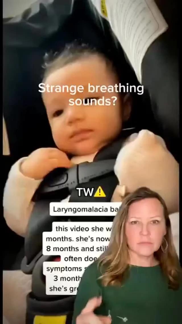 Understanding Laryngomalacia: Essential Guide for New Parents