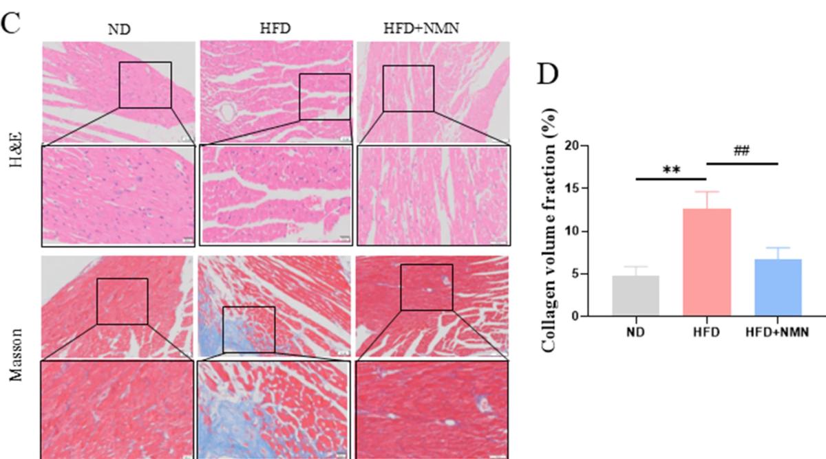 NMN Restores NAD, Shields Heart via SIRT3