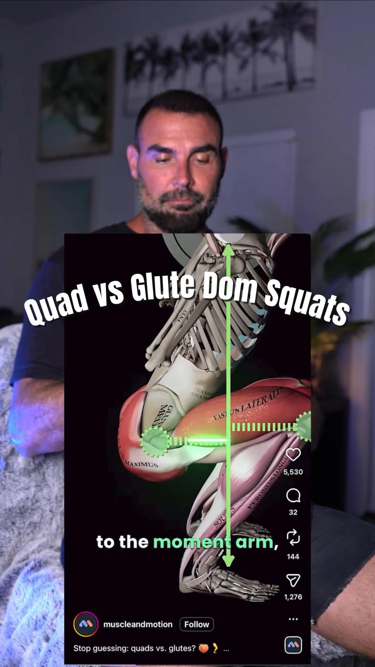 Long Femurs? Use Smith or Hack for Quad Focus