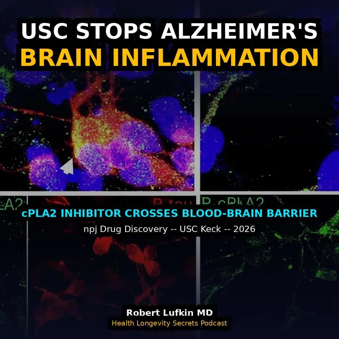 USC Compound Halts Alzheimer-Linked Brain Inflammation
