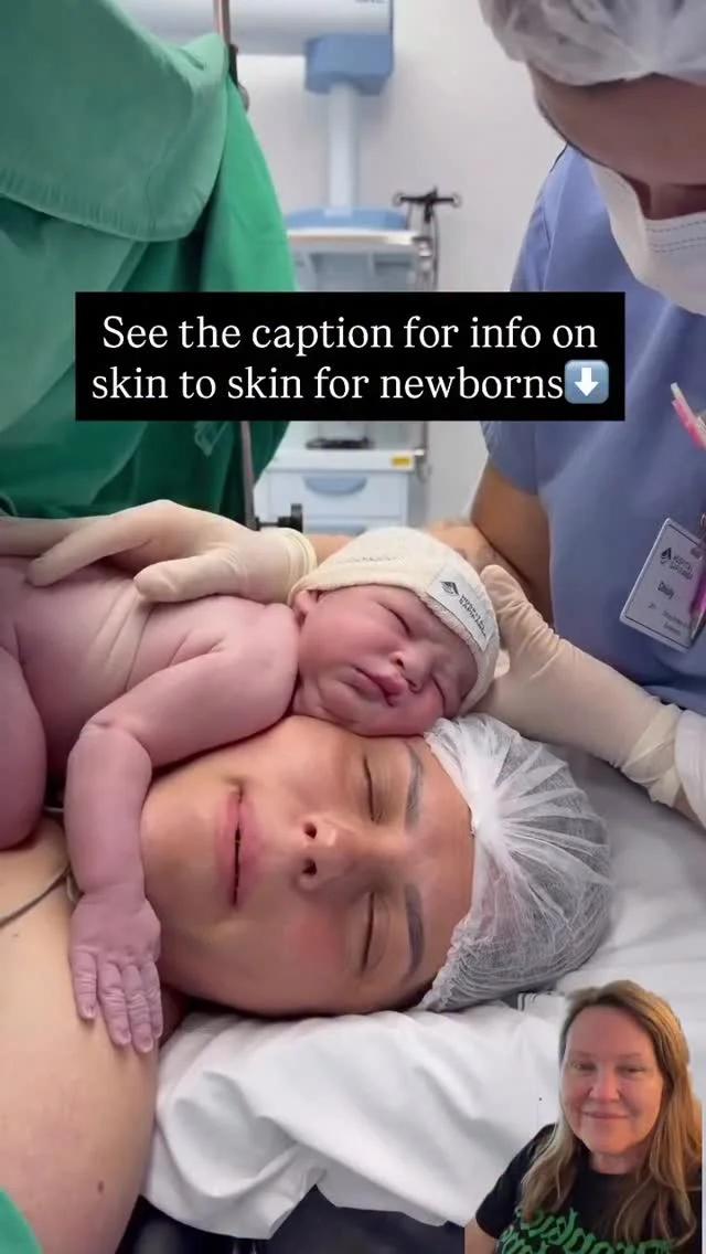 Skin-to-Skin Contact Boosts Newborn Breastfeeding Success