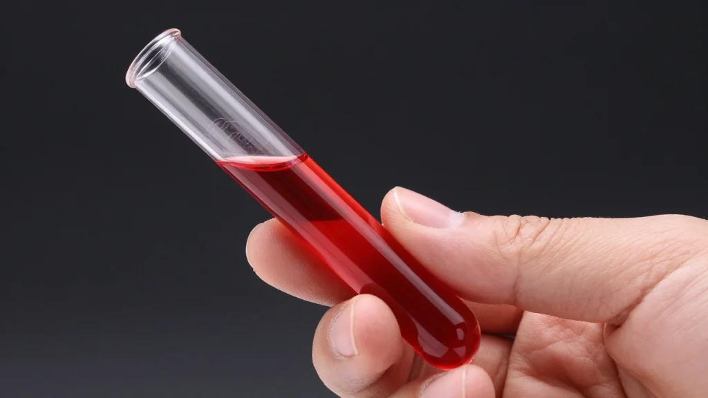 Roche Secures CE Mark for Elecsys NfL Blood Test to Track MS Neuroinflammation