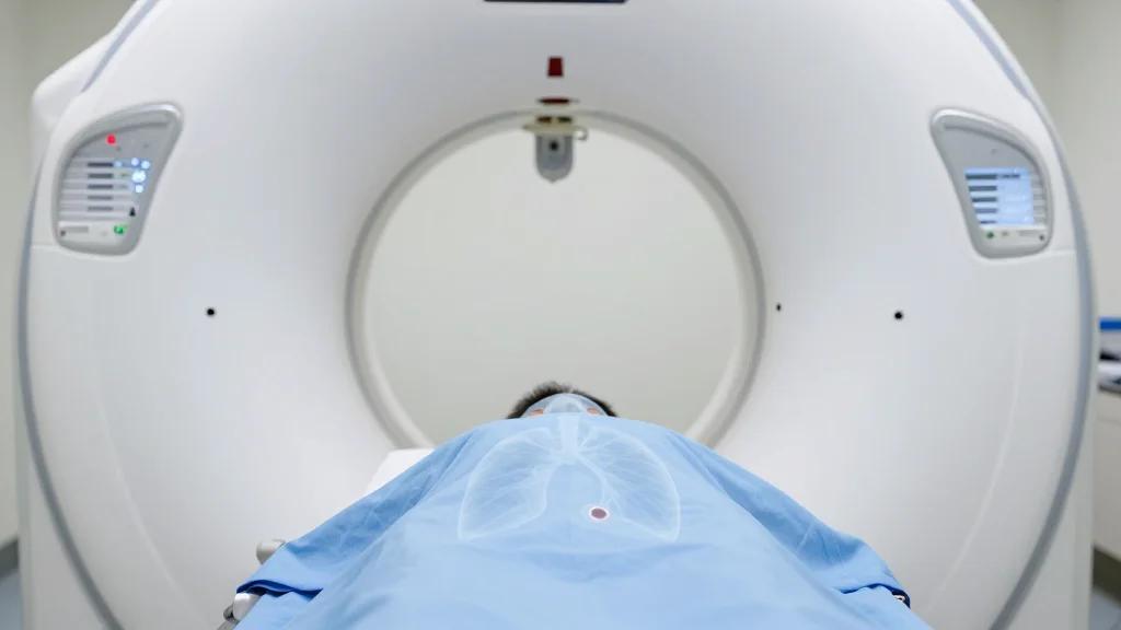 Bronchial Branch Tracing with Cone-Beam CT Tool-in-Lesion Confirmation for Peripheral Pulmonary Nodules